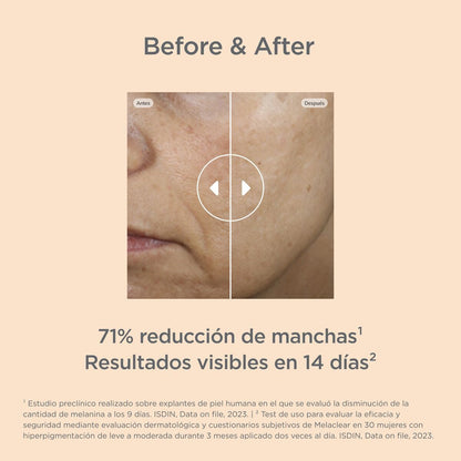 Isdinceutics Malaclear 1,8% 30 ml-4