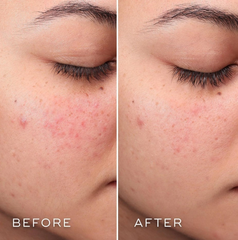 Medik8 Press & Clear 150 ml-3