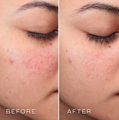 Medik8 Press & Clear 150 ml-3