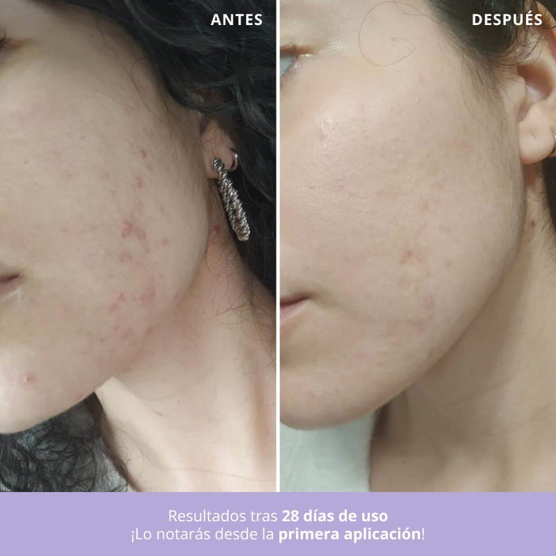 Freshly Cosmetics Azelaic Radiance Face Treatment 50 ml-3