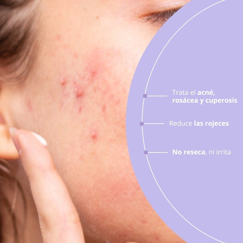 Freshly Cosmetics Azelaic Radiance Face Treatment 50 ml-5
