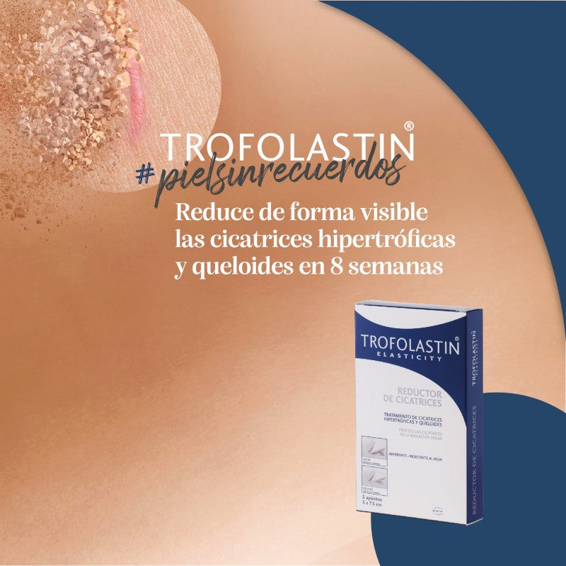 TROFOLASTIN Reductor de Cicatrices Periareolar 3x2 parches-3