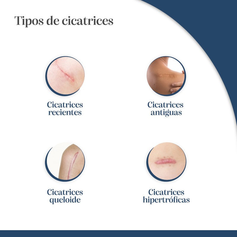 TROFOLASTIN Reductor de Cicatrices Periareolar 3x2 parches-6