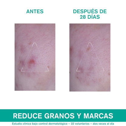 URIAGE Hyseac 3-Regul+ 40 ml-6