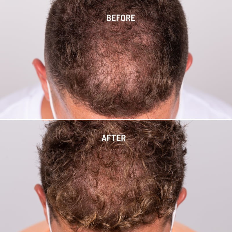 Freshly Cosmetics Hair Growth & Density Treatment 50ml-3