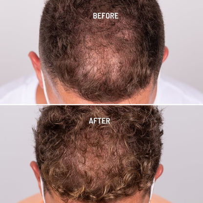 Freshly Cosmetics Hair Growth & Density Treatment 50ml-3