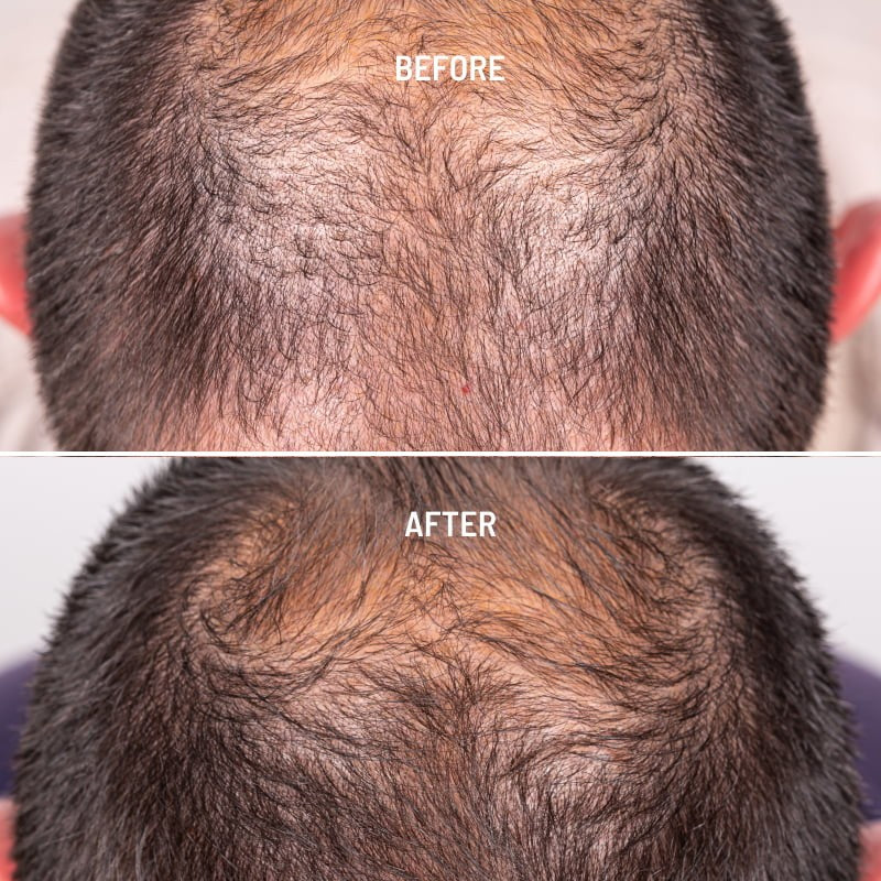 Freshly Cosmetics Hair Growth & Density Treatment 50ml-2