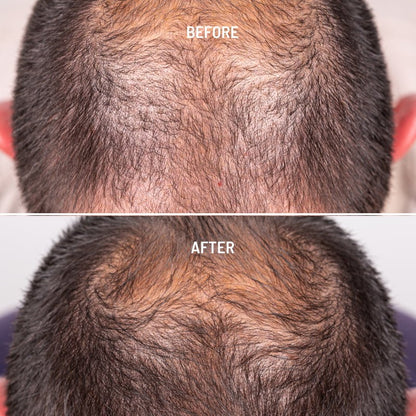 Freshly Cosmetics Hair Growth & Density Treatment 50ml-2