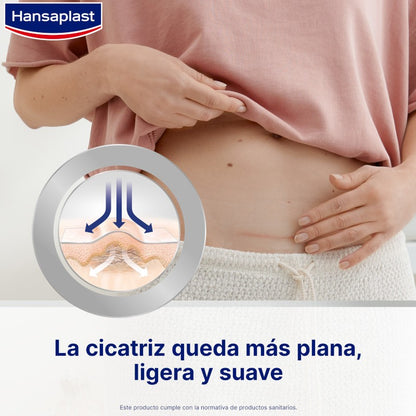 HANSAPLAST Reductor de Cicatrices XL 21 apósitos 146x30mm-5
