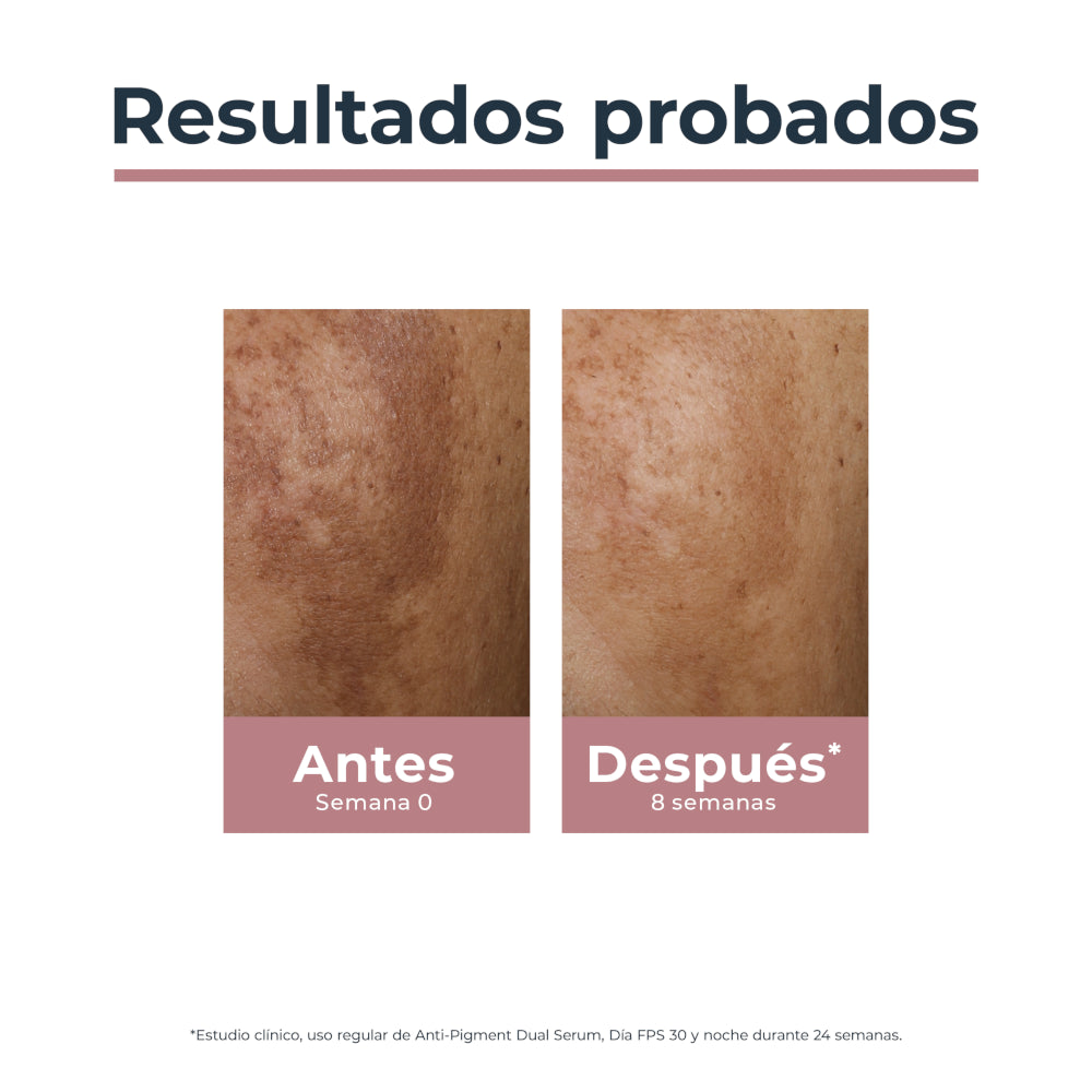 EUCERIN Anti-Pigment Antimanchas Crema de Noche 50ml