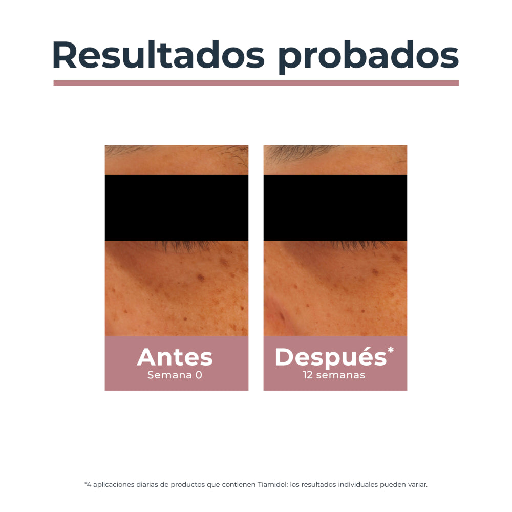 EUCERIN Anti-pigment Contorno de Ojos 15ml