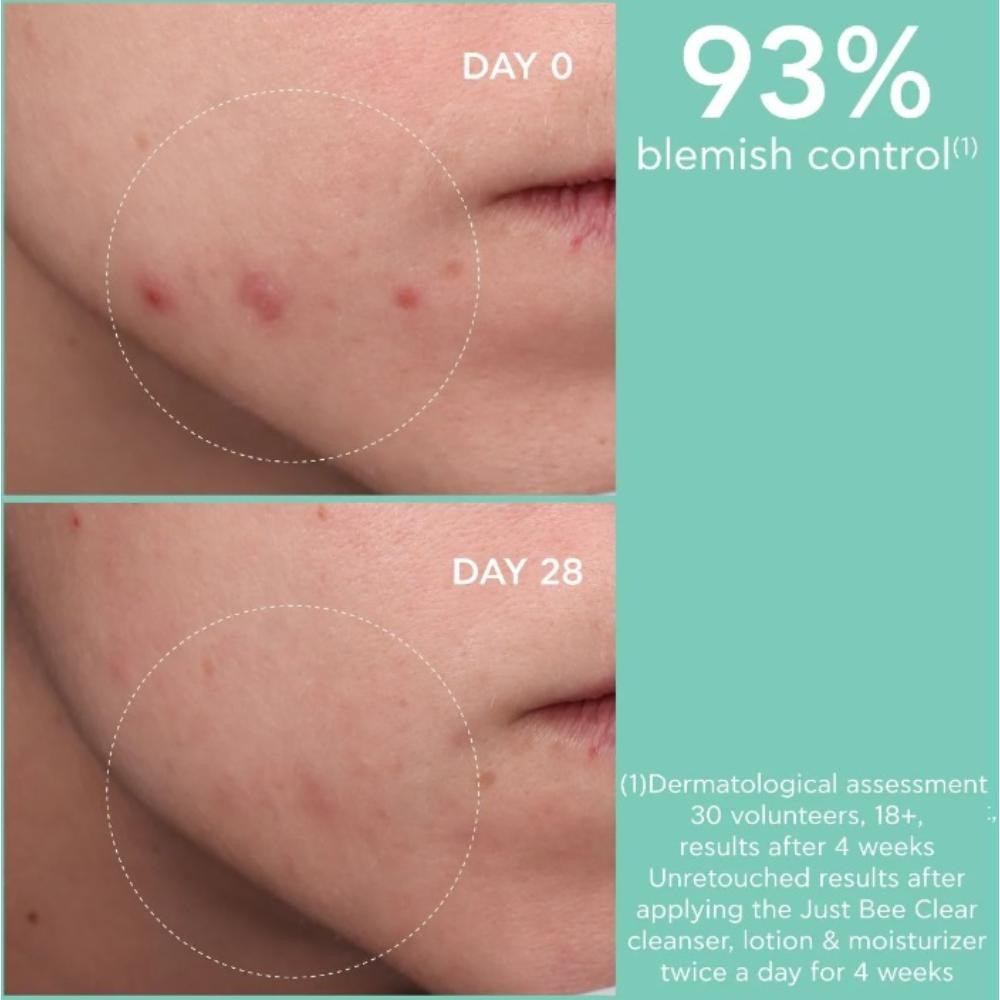 Apivita Just Bee Clear Crema Anti-Imperfecciones Matificante Hidratante 40 ml-4