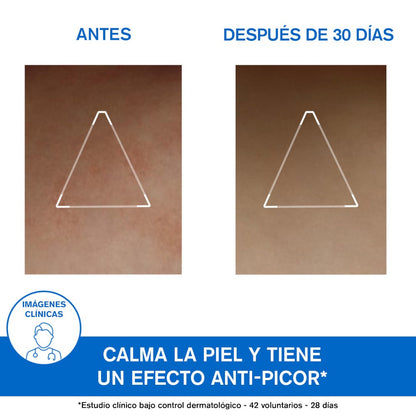 URIAGE Xémose Cera Relipidizante Anti-Irritaciones 200 ml-4