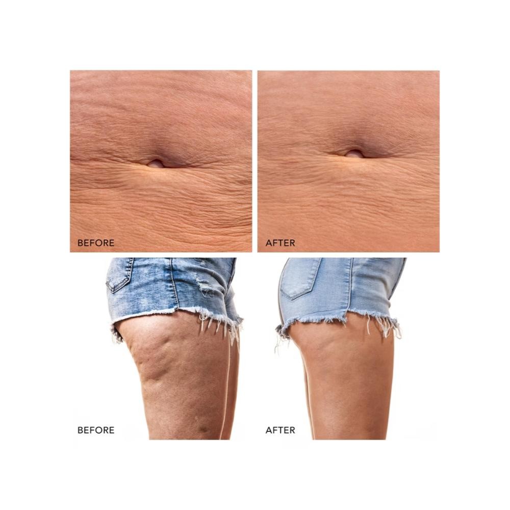 FOREO BEAR 2 Body Dispositivo Tonificador Verde 1 ud-6