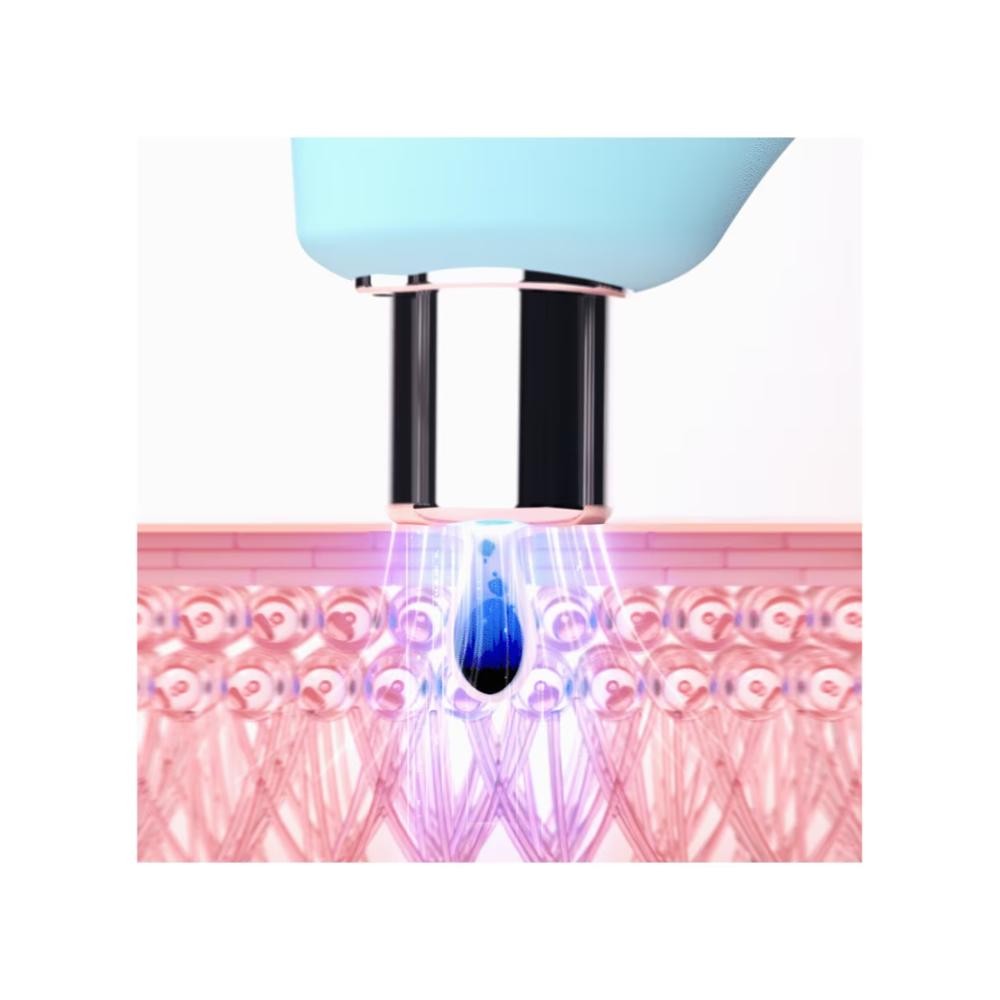 Foreo KIWI Limpiador de Puntos Negros Luz LED Azul 1 ud-3