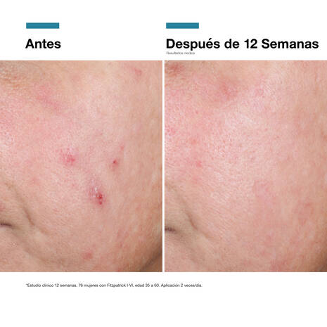 SkinCeuticals Advanced RGN 6 50ml