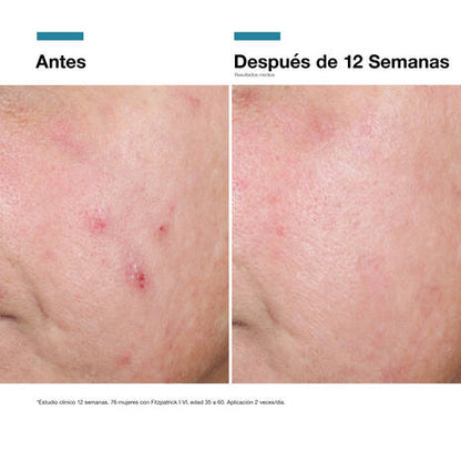 SkinCeuticals Advanced RGN 6 50ml